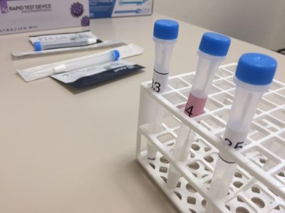 Sanidad constata 227 nuevos casos de covid-19 en personas de m&aacute;s de 60 a&ntilde;os desde el pasado viernes 10-03-23