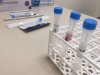 Sanidad constata 227 nuevos casos de covid-19 en personas de m&aacute;s de 60 a&ntilde;os desde el pasado viernes 10-03-23