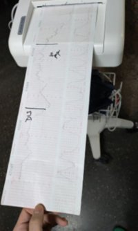 El HUC colabora en la organizaci&oacute;n de un curso de registros cardiotocogr&aacute;ficos