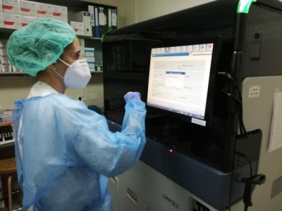 Sanidad constata un caso positivo y notifica cinco en estudio de viruela del mono desde el viernes