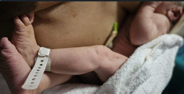 Sanidad amplía el cribado neonatal a 31 enfermedades raras