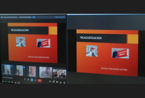 El Hospital Universitario de Candelaria realiza el primer taller en línea de la Escuela de Pacientes de Canarias