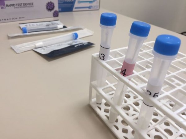Sanidad notifica 225 nuevos casos de covid-19 en personas de más de 60 años en los últimos tres días