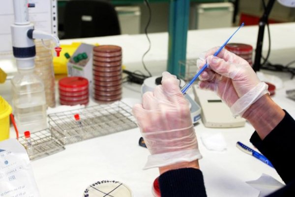 Sanidad comienza a realizar las pruebas diagnósticas de infección por viruela del mono