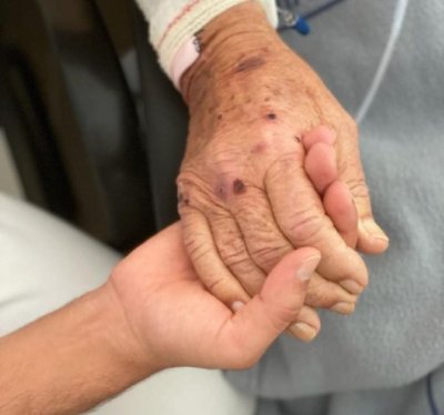 M&aacute;s de 134.000 pacientes se benefician del programa AP_Cuida2 para el seguimiento en domicilio tras el alta