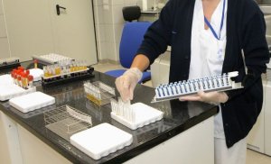Sanidad constata un caso confirmado de viruela del mono desde el viernes