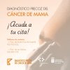 Sanidad recuerda la importancia del programa de cribado poblacional del cáncer de mama para la detección precoz