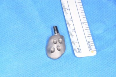 Profesionales del HUC desarrollan con el ITC una pr&oacute;tesis menos invasiva para la articulaci&oacute;n temporomandibular