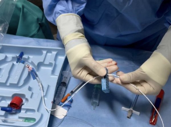 El Hospital Universitario de La Palma incorpora la punción ecoguiada en la terapia intravenosa