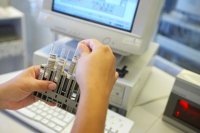 Sanidad comunica un caso confirmado y cinco en estudio de viruela del mono desde el viernes