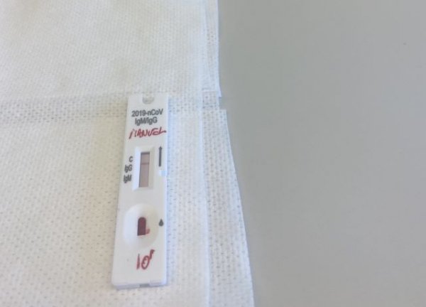 (26-01-22) Sanidad comunica 2.327 casos de COVID-19 en las &uacute;ltimas 24 horas