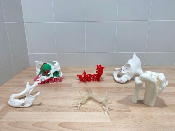 El Hospital Doctor Negrín pone en marcha una unidad destinada a integrar la tecnología 3D en la práctica clínica