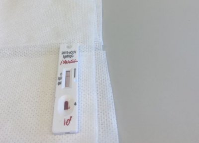 Sanidad notifica provisionalmente 254 casos de COVID-19 en las &uacute;ltimas 24 horas