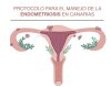 Sanidad pone en marcha un protocolo asistencial para atenci&oacute;n a mujeres con endometriosis