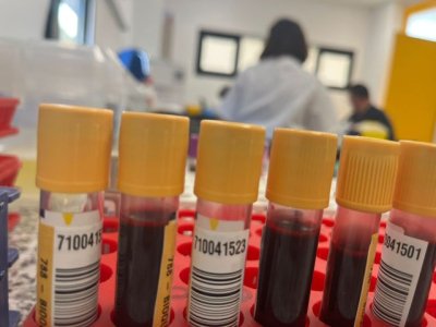 Sanidad comienza a administrar la terapia génica para la Hemofilia B