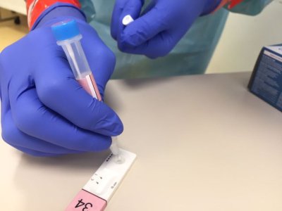 Sanidad constata 170 nuevos casos de covid-19 en personas de m&aacute;s de 60 a&ntilde;os desde el pasado viernes